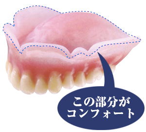インプラント
