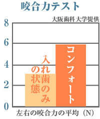 インプラント